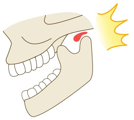 CHASQUIDOS CHASQUIDOS